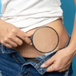 Women Show off the belly after birth Women Show off the belly after birth