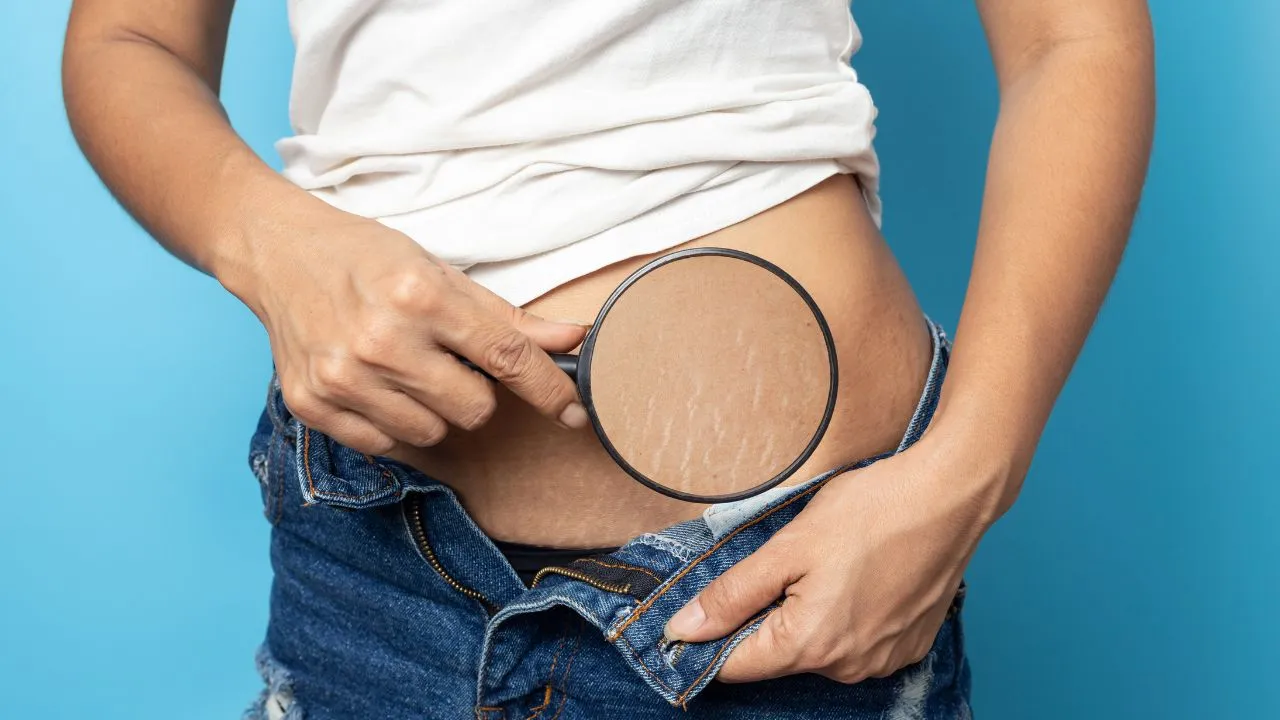 Women Show off the belly after birth Women Show off the belly after birth