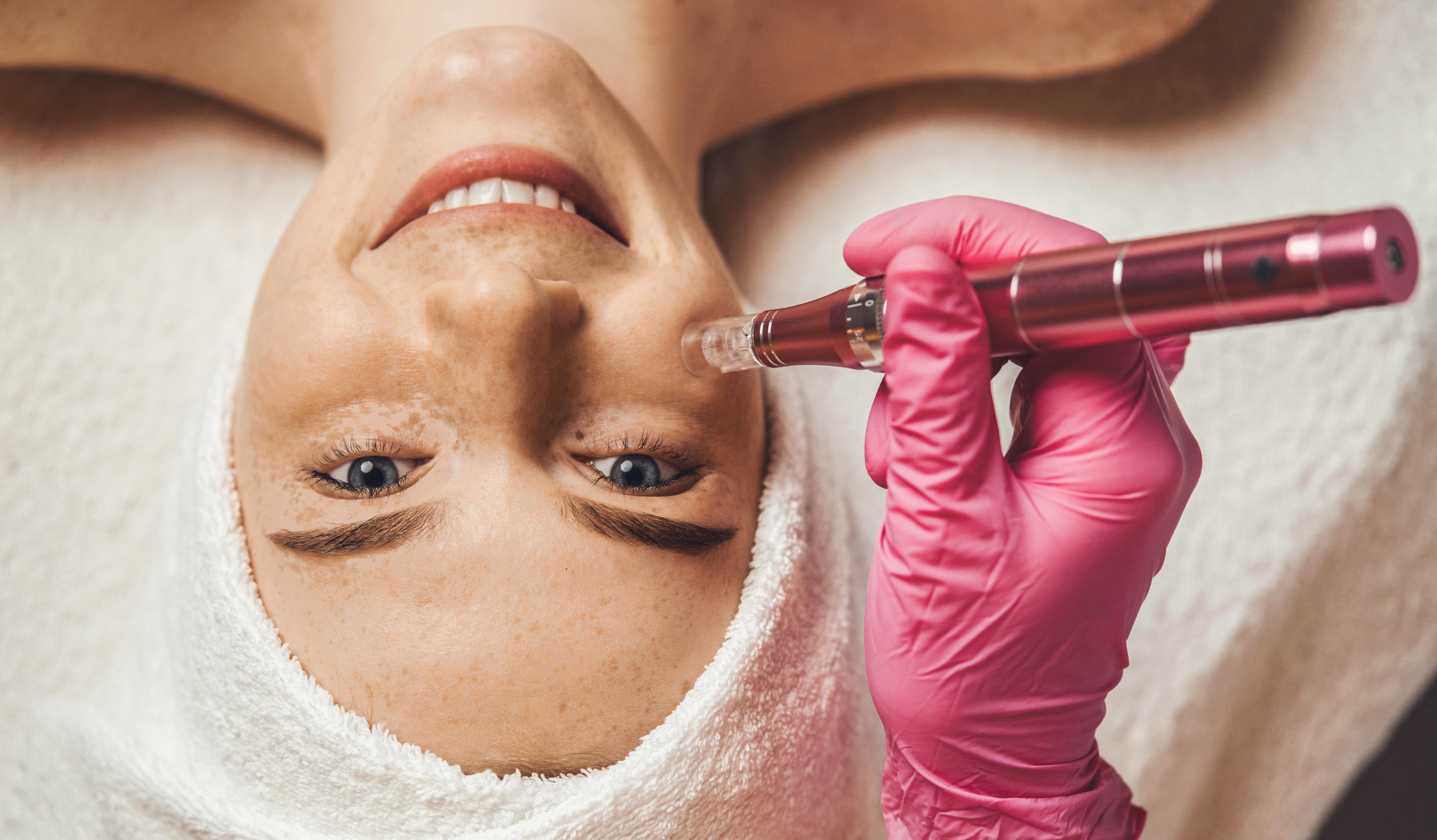 Cosmetologist's hand doing procedure of microneedling to the patient's smiling face.