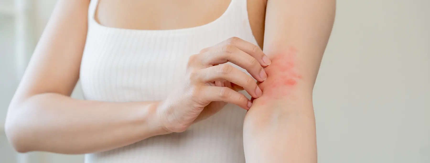 Person scratching red irritated skin on arm.
