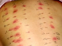 skin allergy patch testing
